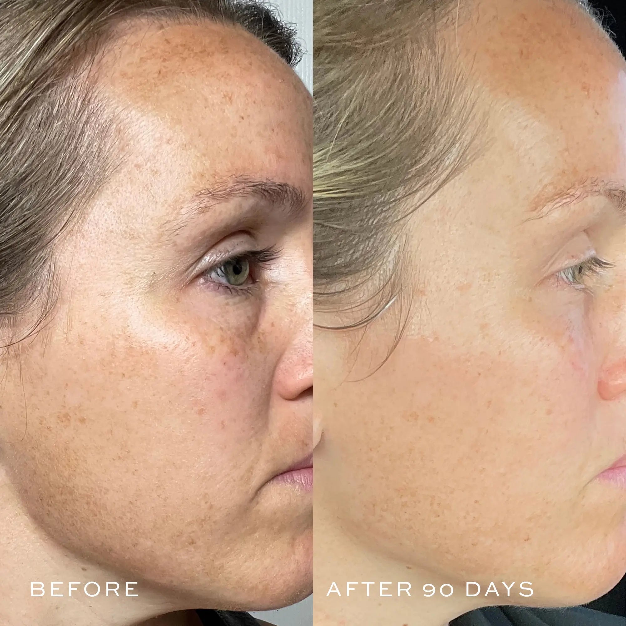 TBT® Serum (Anti-Aging Serum)