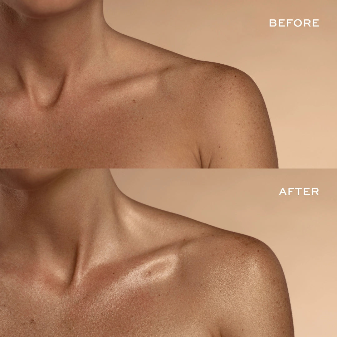 Before and after comparison of chest and shoulder area showing skin texture and appearance difference.