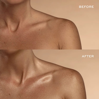 Before and after comparison of chest and shoulder area showing skin texture and appearance difference.