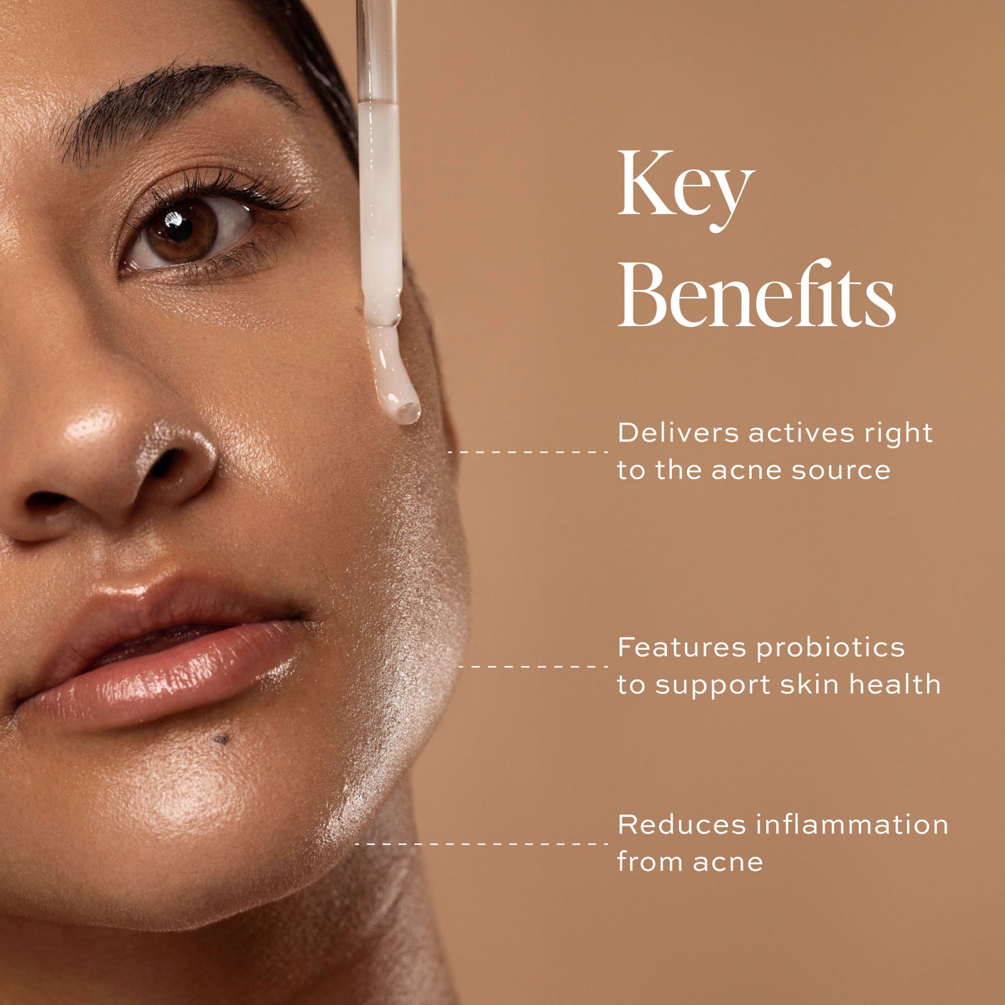 key benefits