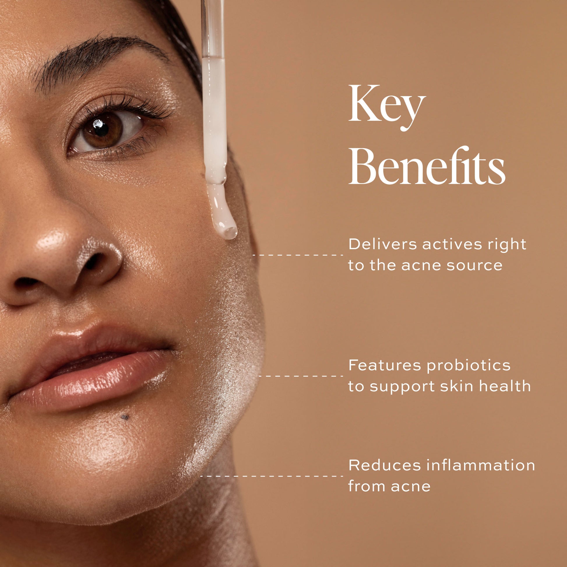 key benefits