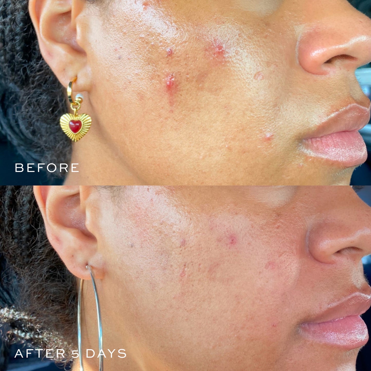 before & after