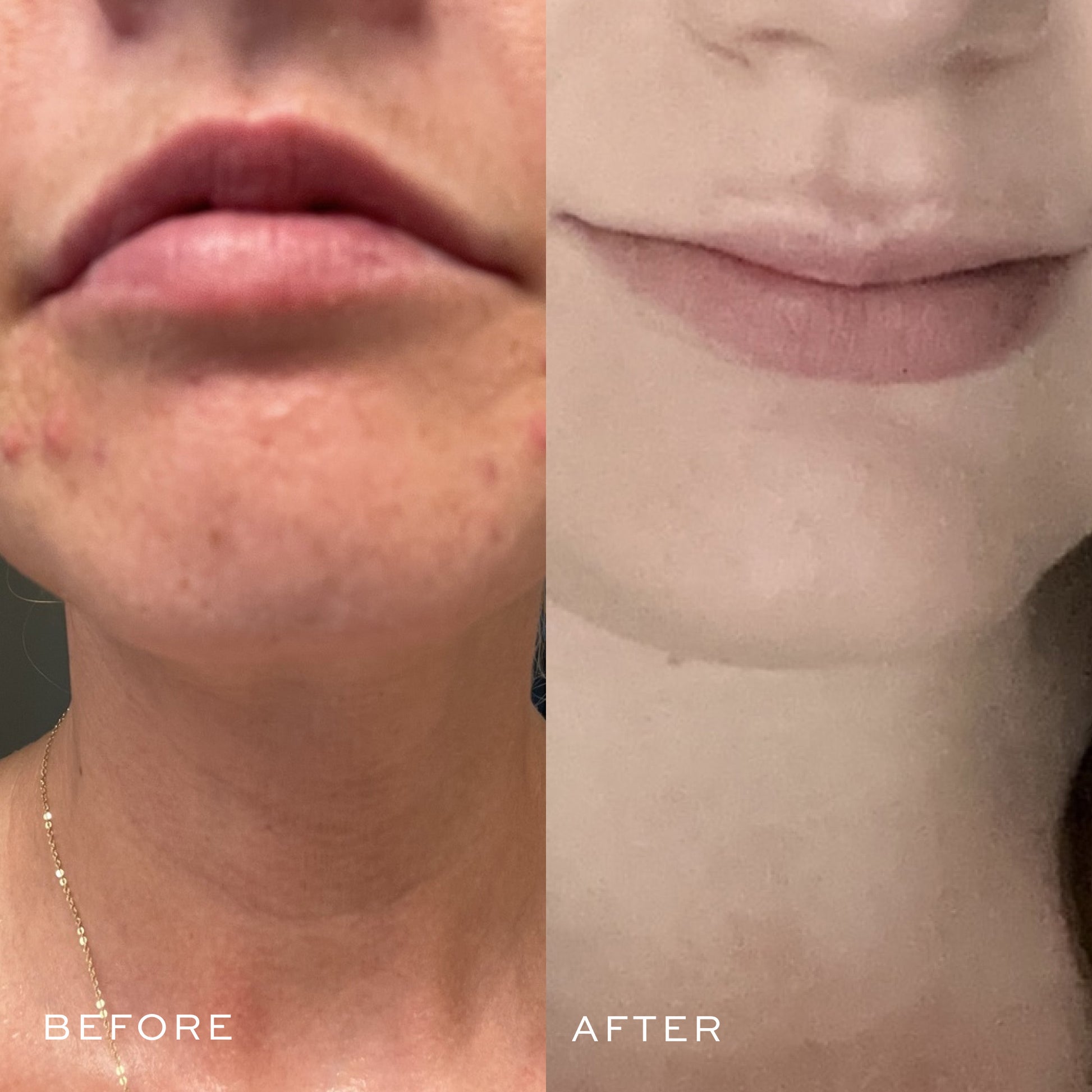 before & after
