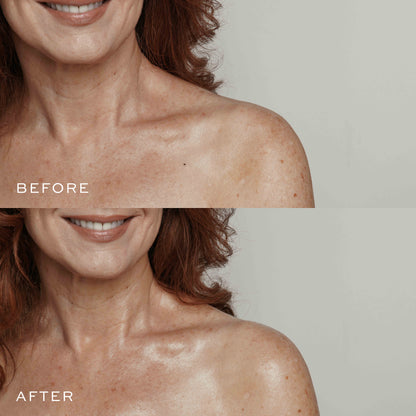 Before & After