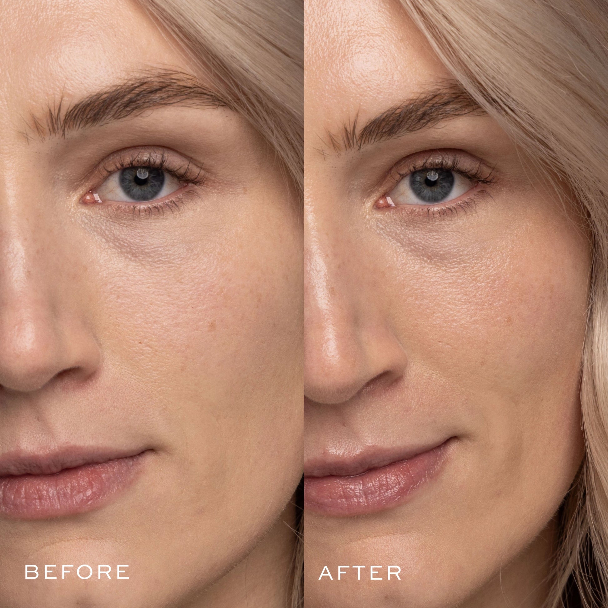 Dewy Day Cream Before & After