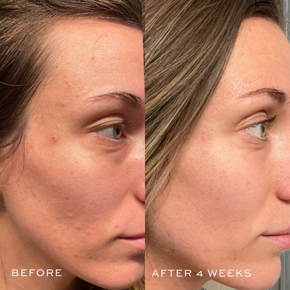 Before & After