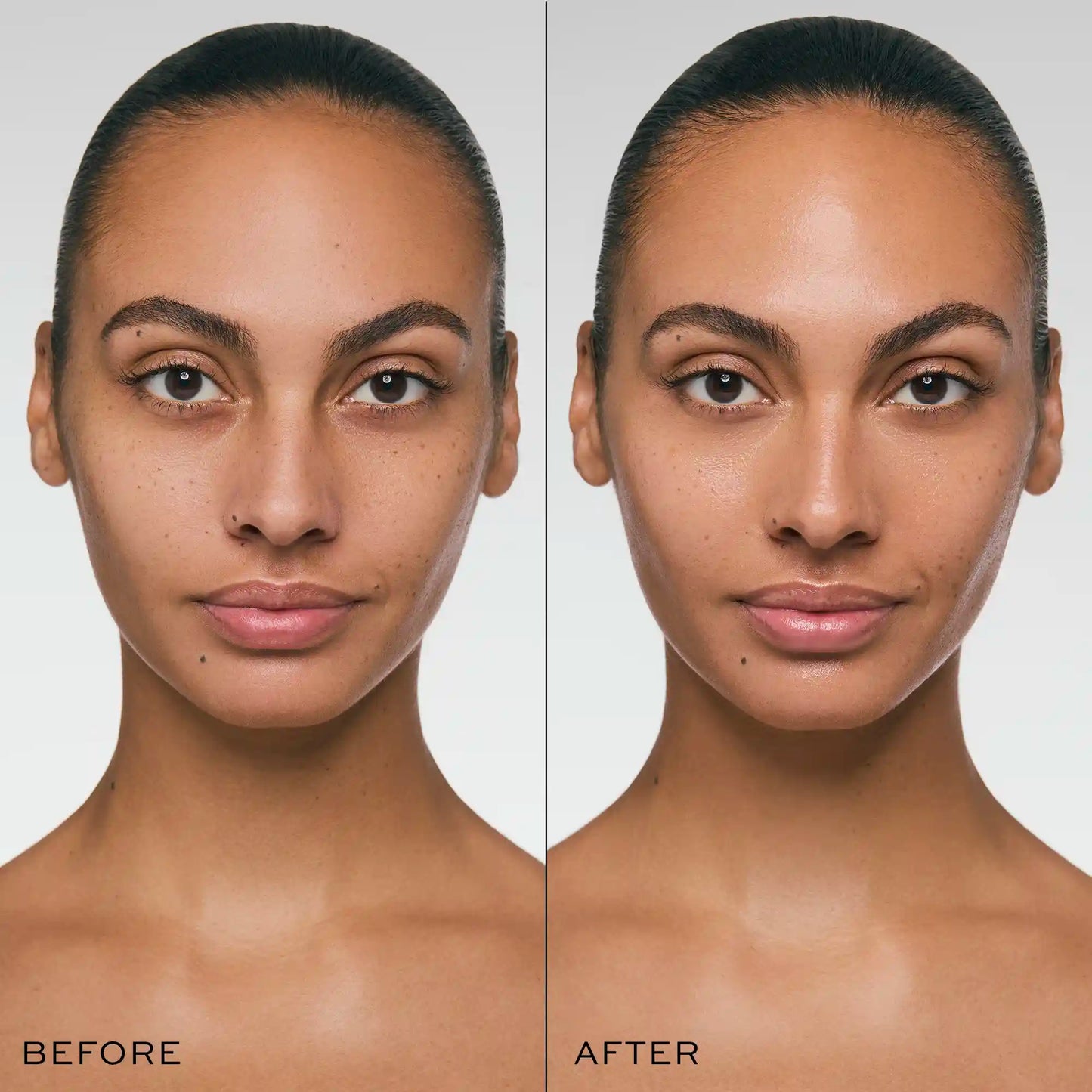 Before and after comparison of skin texture on woman's face showing reduced appearance of blemishes and smoother complexion.