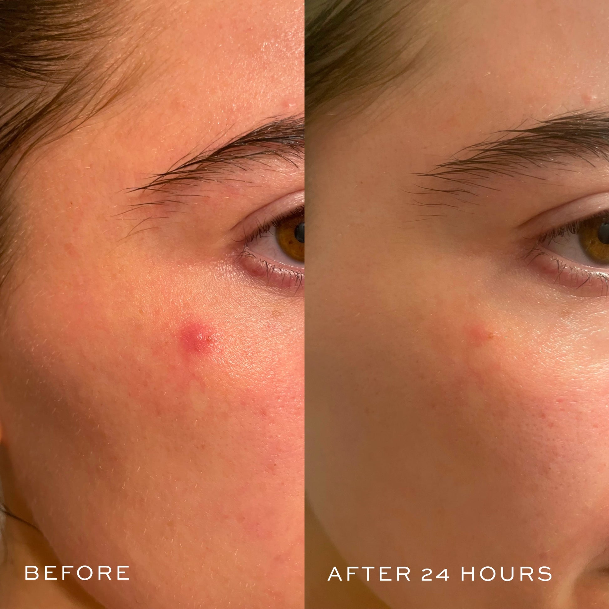 Before & After