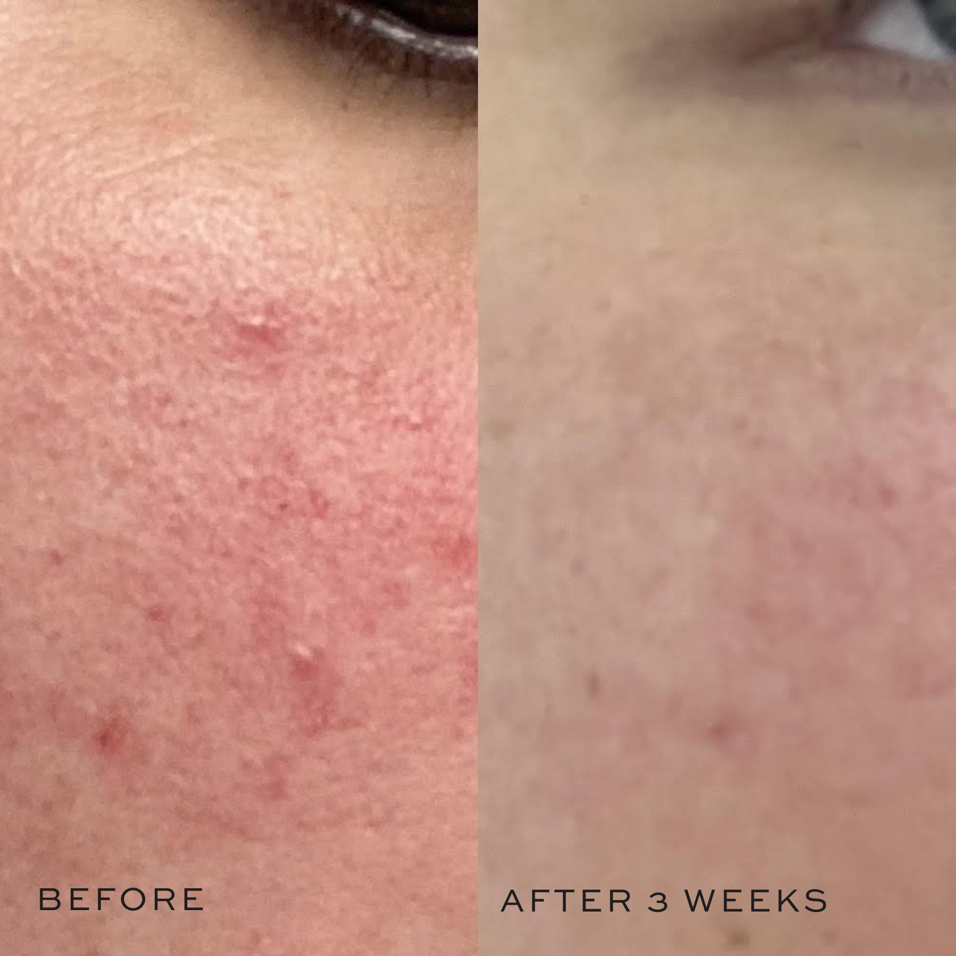 Super Skin Toner Before & After
